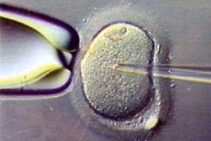 Injection intra-cytoplasmique de spermatozoïde