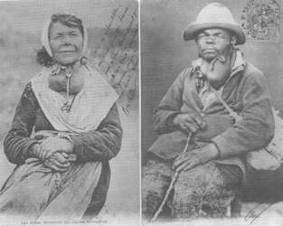 Les crétins goitreux des  Hautes Alpes sur les cartes postales de 1847 à 1851