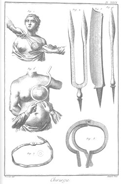 Techniques chirurgicales pour l’ablation du cancer du sein.